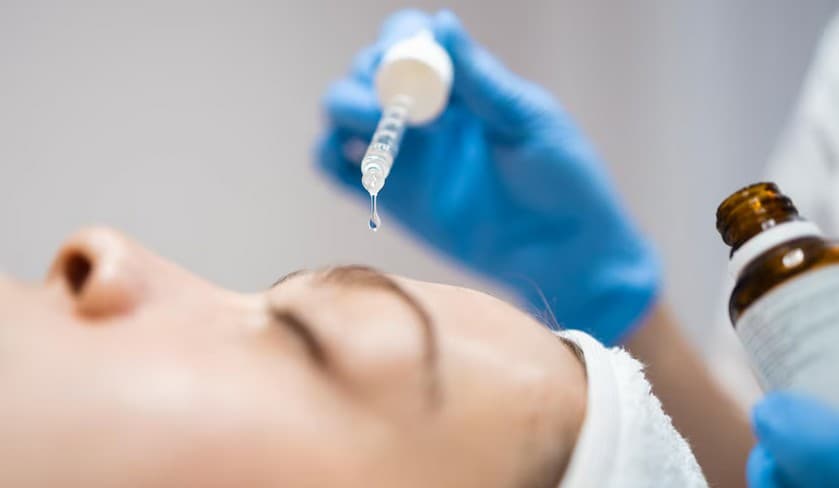 Azac Peel – kwas azelainowy