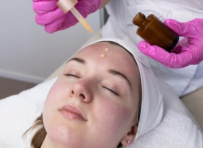 Pyruvic Peel – kwas pirogronowy